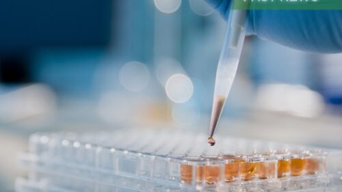 Joinn Laboratories, China’s leading non-clinical contract research organization (CRO), announced on Tuesday it expects to report a net profit of 311 million to 419 million yuan for 2023, down 61.1% to 71.1% from the previous year.